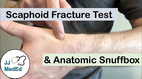 scaphoid fracture compression test|scaphoid fracture physical exam.